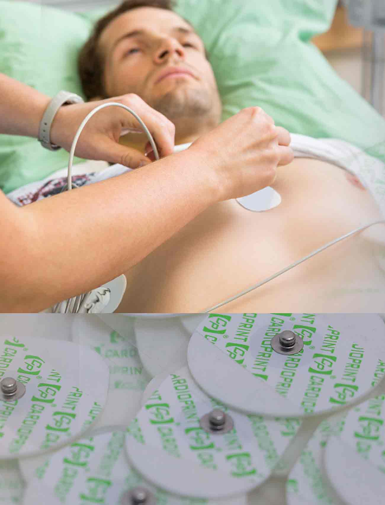 Disposable ECG Electrodes